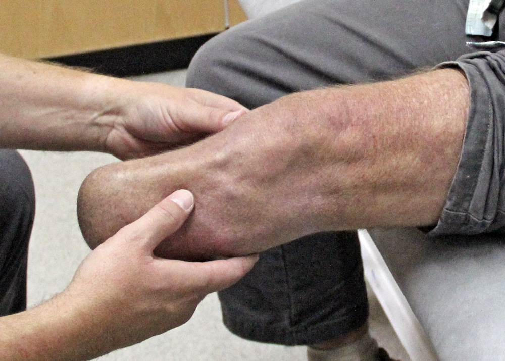 Improved Limb Health