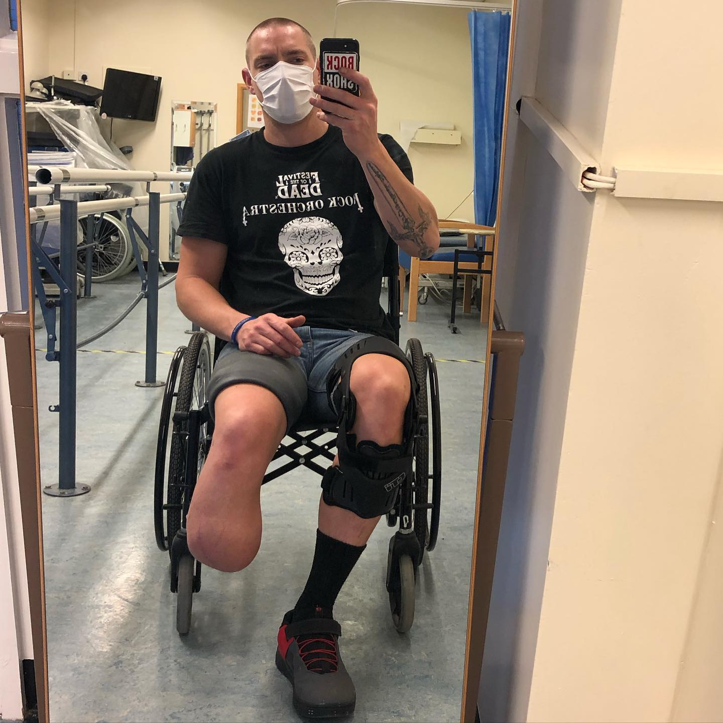 A quick selfie to document his amputation journey